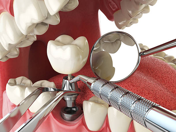 Best Emergency Dentist for Special Needs Patients in Cerritos, CA